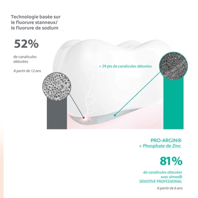 Diagramme montrant l'efficacité d'Elmex Sensitive, qui obture les canalicules dentinaires pour réduire la douleur. 