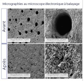 Micrographies au microscope électronique à balayage