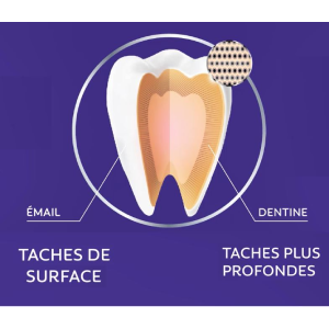 Tarches de surface